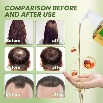 🔥LAST DAY 50% OFF !!🎁Batana Oil & Rosemary Shampoo - Nourishing Volumizing Shampoo for Men and Women